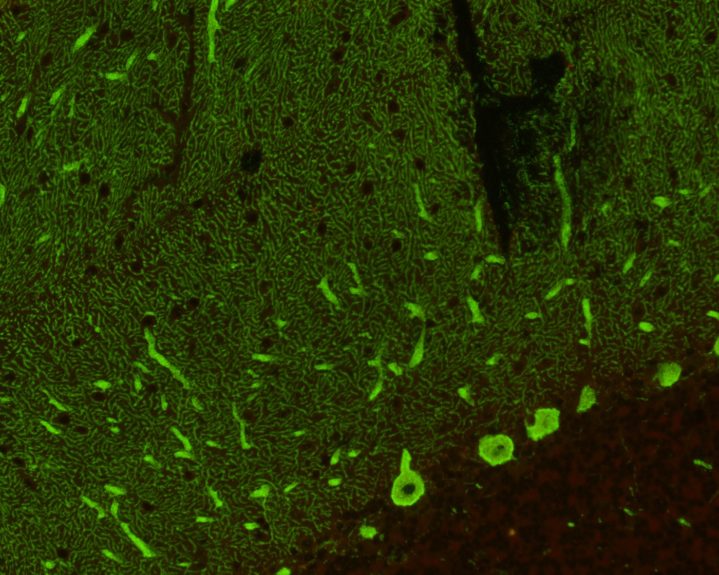 Immunofluorescence microscopy image from neuro-immunology research
